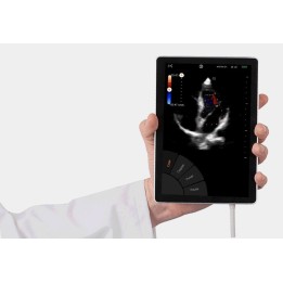Echographe U-Lite EXP à La Réunion | Démonstration gratuite
