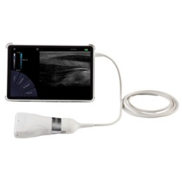 Echographe U-Lite Pro Réunion | Le meilleur ultra-portable