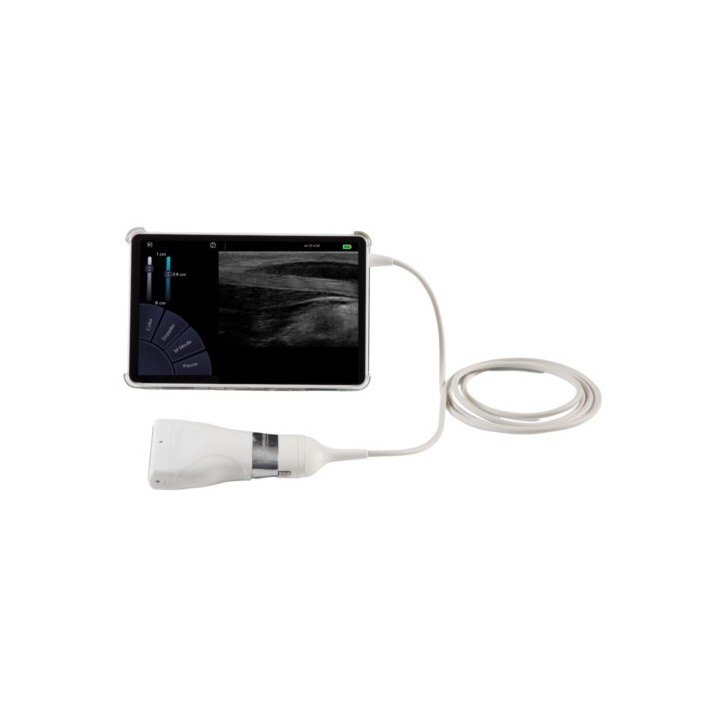 Echographe U-Lite Pro Réunion | Le meilleur ultra-portable