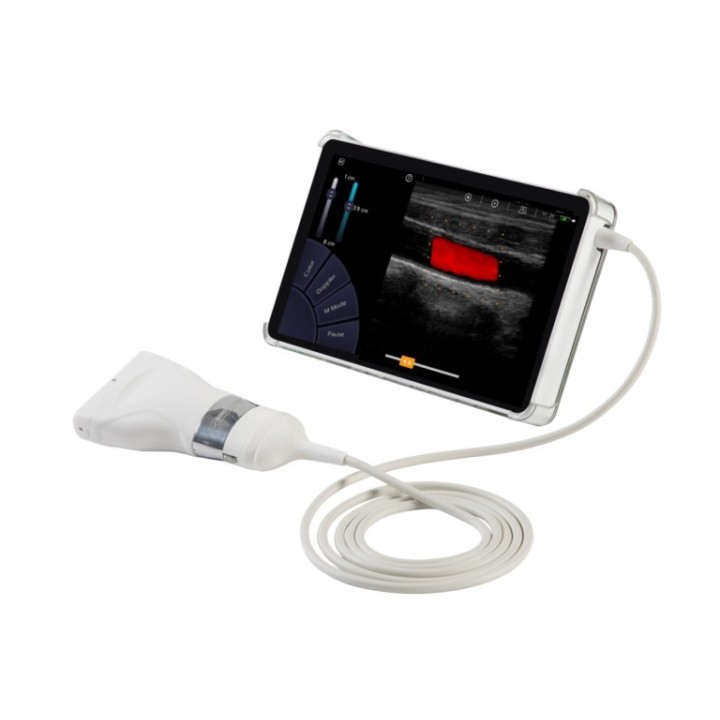 Echographe U-Lite Pro Réunion | Le meilleur ultra-portable