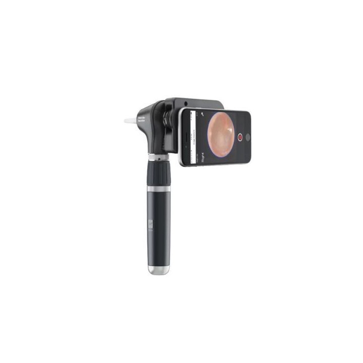 Otoscope connecté rechargeable Macroview à La Réunion