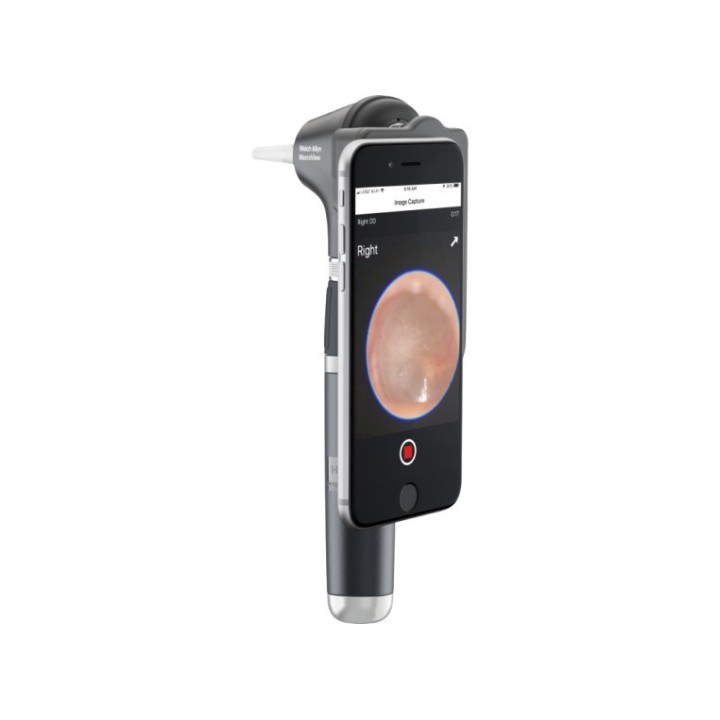 Otoscope connecté rechargeable Macroview à La Réunion