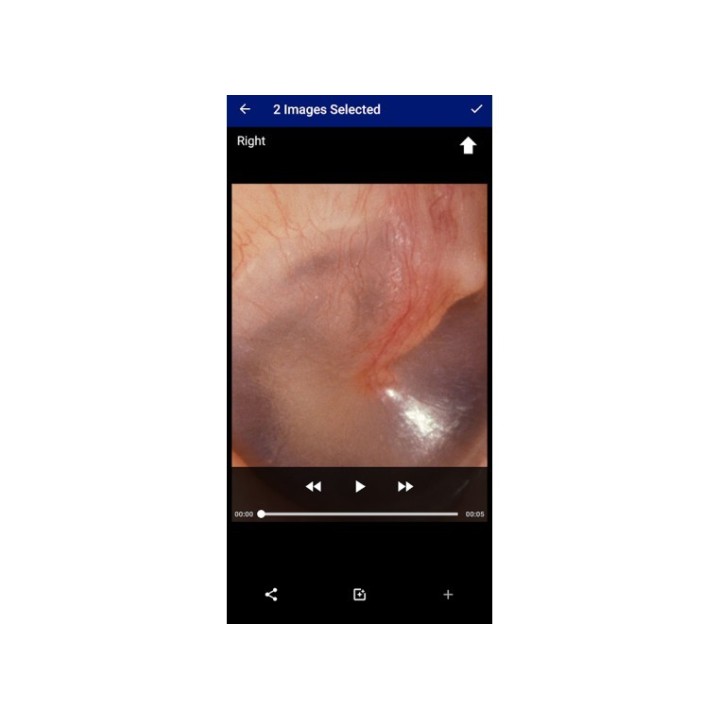 Otoscope connecté rechargeable Macroview à La Réunion