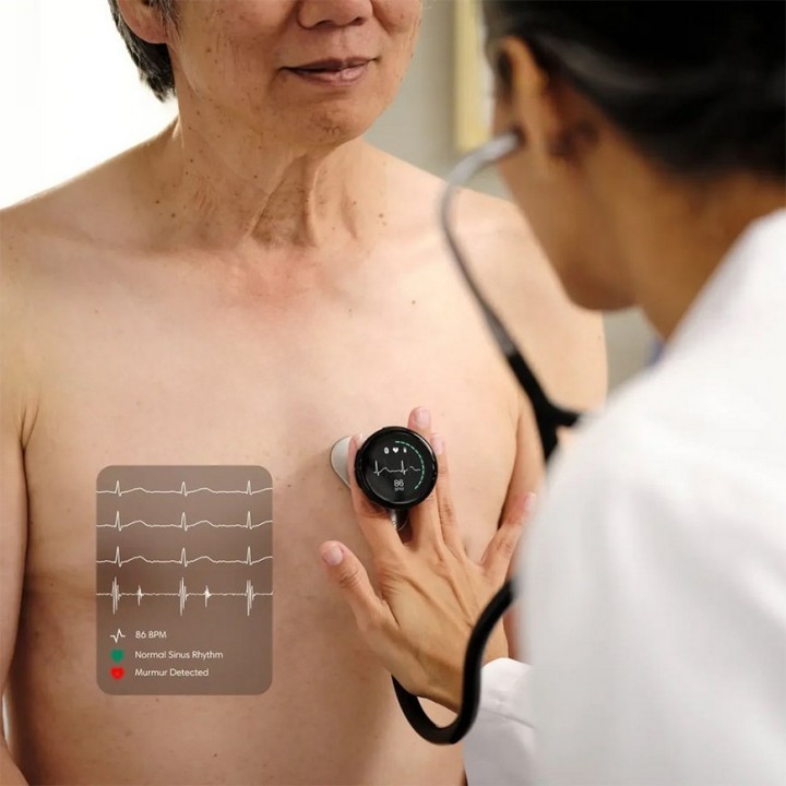 Stéthoscope connecté EKO Core à La Réunion